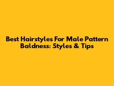 Best Hairstyles For Male Pattern Baldness: Styles & Tips